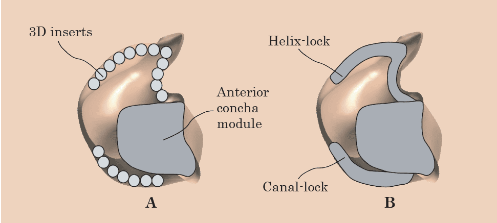 custom hearing aid shell manufacturing