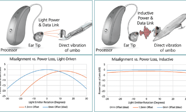 Earlens Contact Hearing Solution Introduced with Inductive Coupling vs Light-Driven Coupling