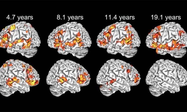 Research Shows Children Use Both Brain Hemispheres to Understand Language