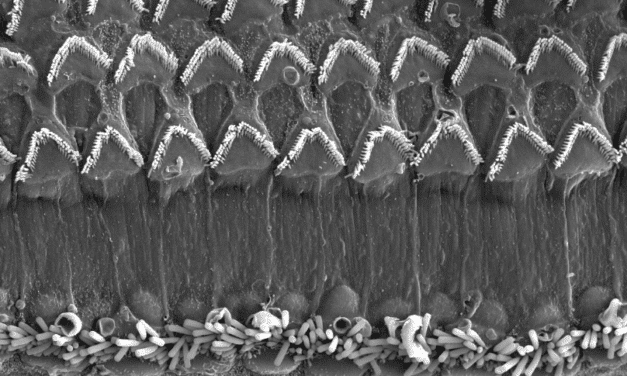 UPenn Researchers ID New Cause of Hearing Loss