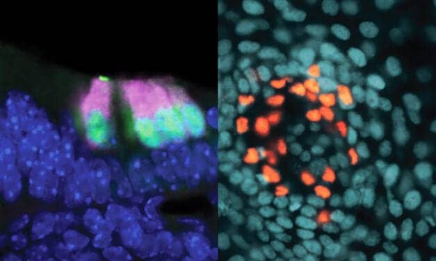Common Ancestor for Cells Involved in Hearing, Touch