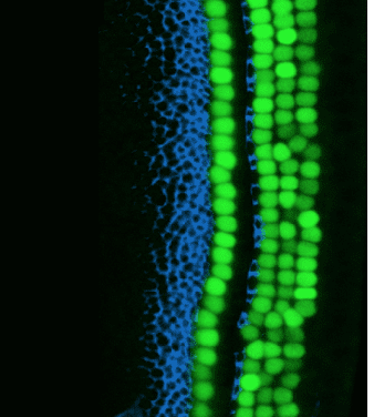 Latent Regenerative Potential of Inner Ear Sensory Cells