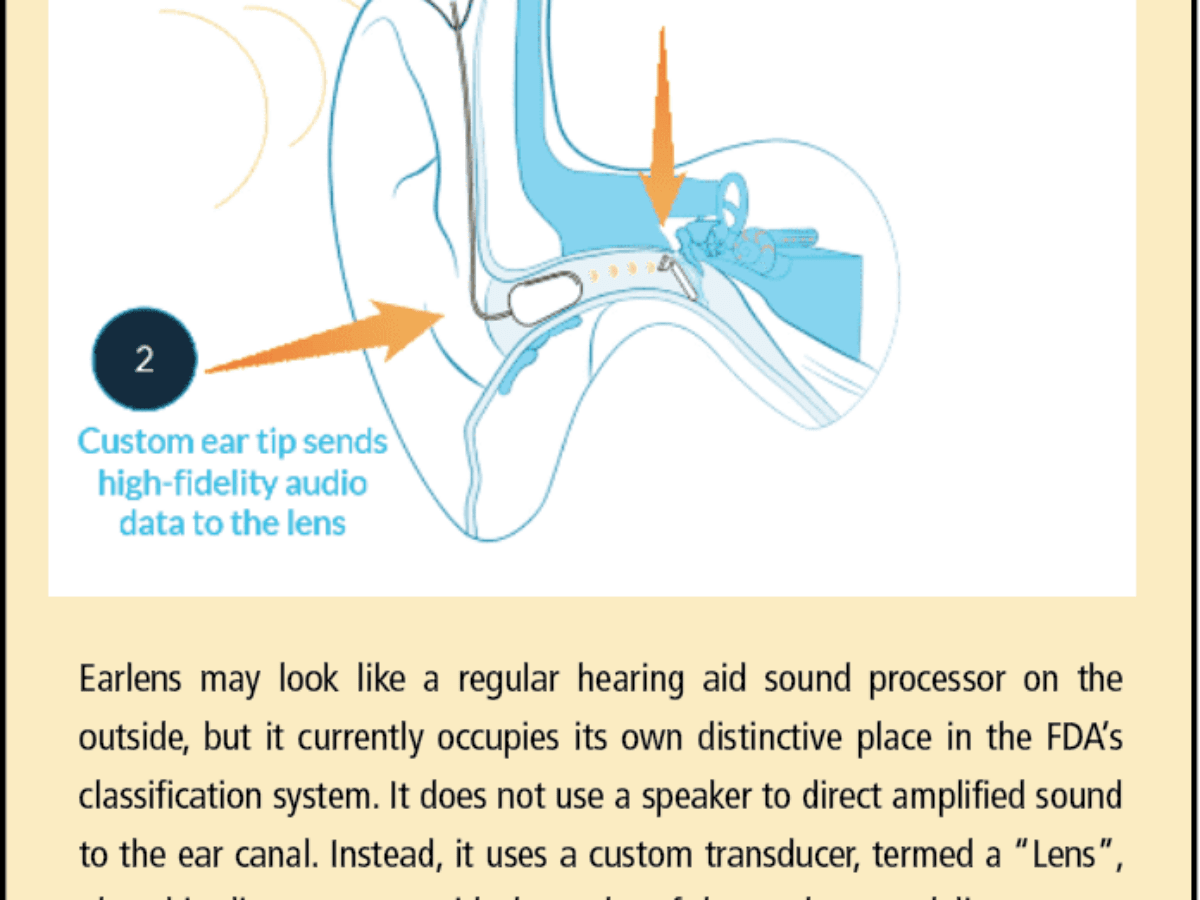 A 10-Year Review of the Earlens System, Part 1: Speech