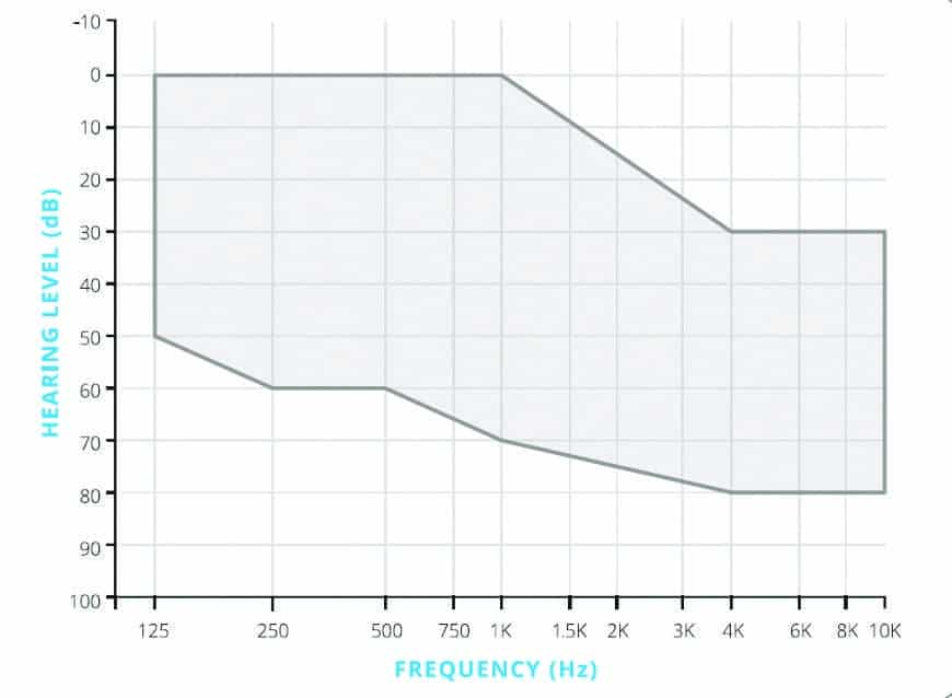 A 10-Year Review of the Earlens System, Part 3: What’s the Big Deal about Audibility and Broader Audible Bandwidth?