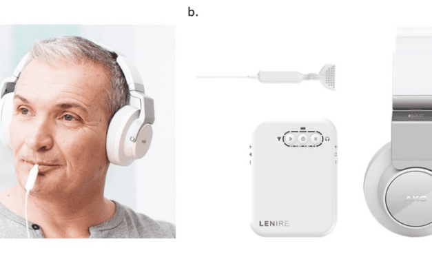 Usability of Bimodal Neuromodulation to Treat Tinnitus