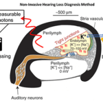 Imaging Test May Pinpoint Age-related Hearing Loss