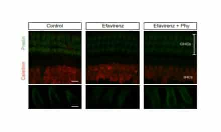 Common Supplements Might Reduce Natural Hearing Loss
