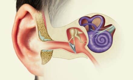 Radiomics Can Predict Hearing Conditions in Vestibular Schwannoma Patients