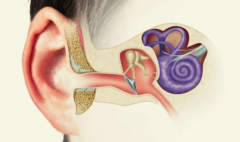 Radiomics Can Predict Hearing Conditions in Vestibular Schwannoma Patients