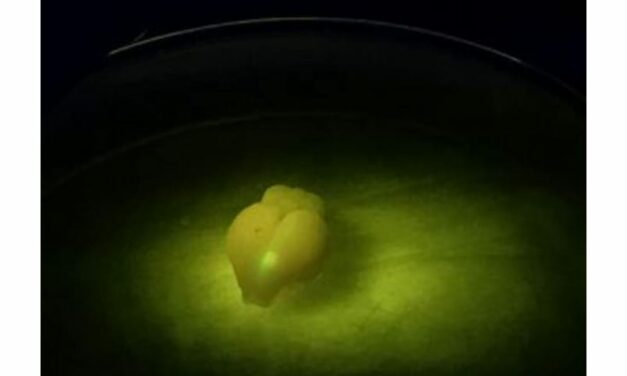 Researchers Uncover Brain Region’s Role in Hearing and Learning