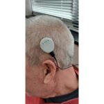 Early Cochlear Implant Activation: Clinical and Surgical Implementation Considerations