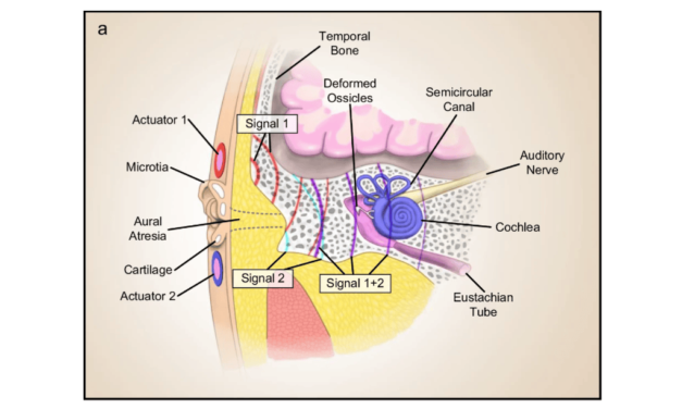 Flexible Hearing Device a Possible Implant Alternative