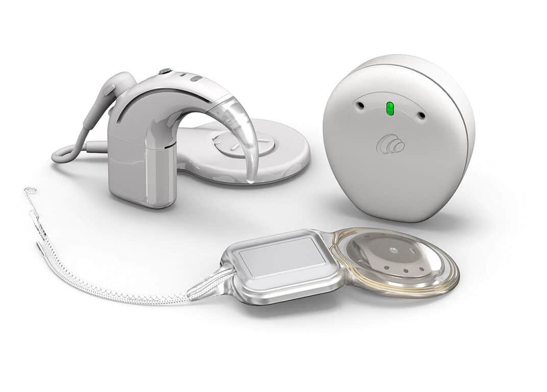Cochlear Launches Smart Cochlear Implant System