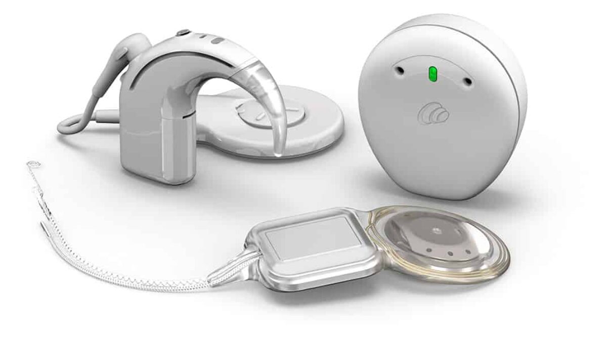 Cochlear Launches Nucleus Nexa Smart Cochlear Implant System | The