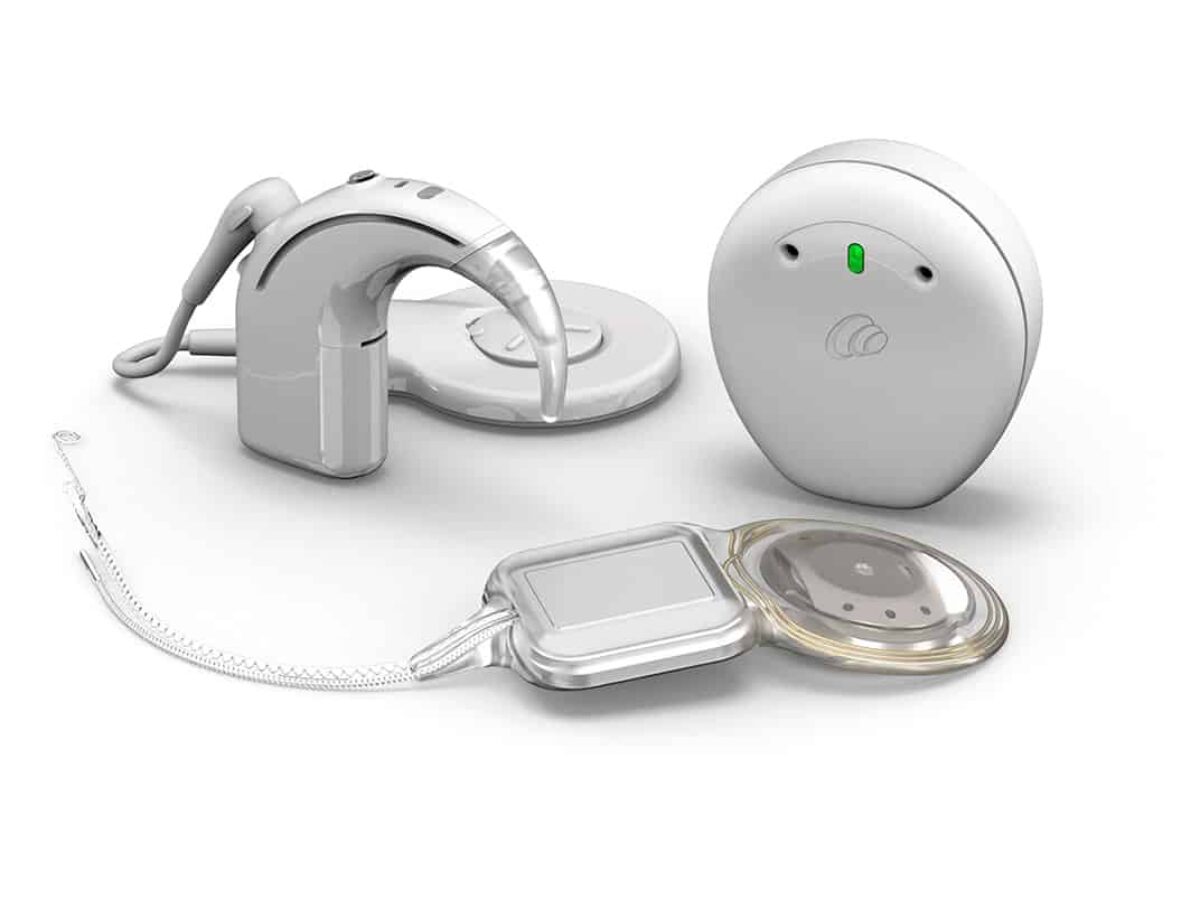 Cochlear Launches Nucleus Nexa Smart Cochlear Implant System | The