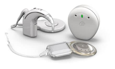 Cochlear Launches Smart Cochlear Implant System