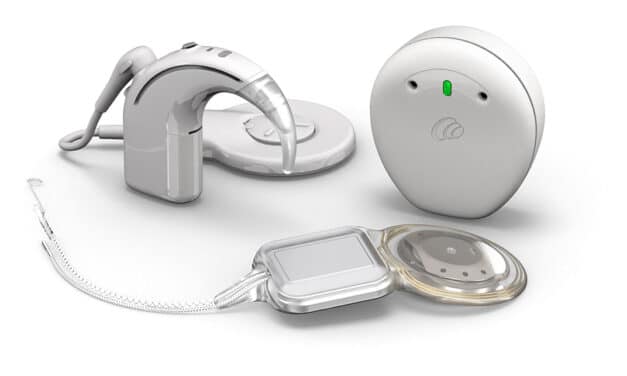 Cochlear Launches Smart Cochlear Implant System