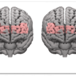 Study: Phonak Infinio Spheres Help Ease Cognitive Demands in Noise