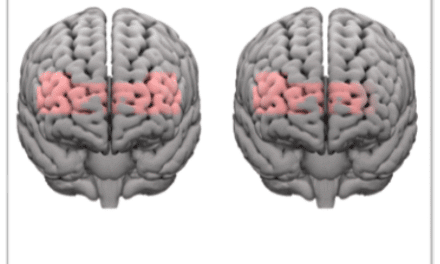 Study: Phonak Infinio Spheres Help Ease Cognitive Demands in Noise