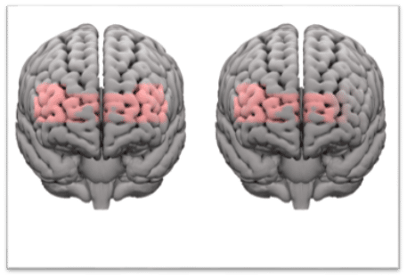 Study: Phonak Infinio Spheres Help Ease Cognitive Demands in Noise