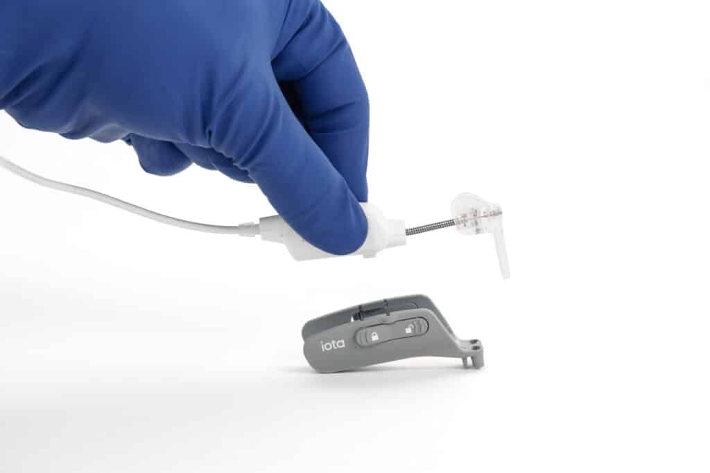 A close-up view of the IotaSoft Robotic-Assisted Cochlear Implant Insertion System. The system is FDA cleared for patients four years of age and older.