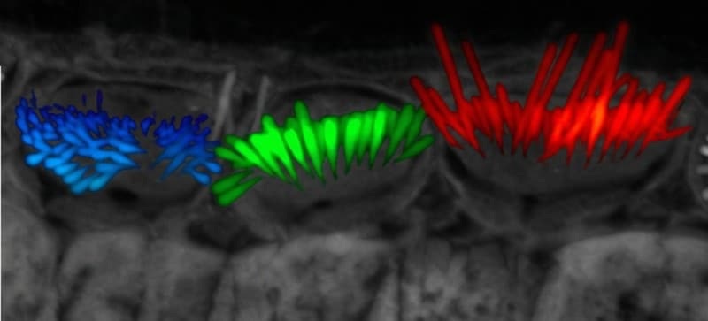 AI Tool Automates 3D Analysis of Cochlear Stereocilia