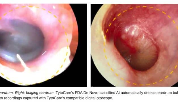 FDA Grants De Novo Classification to TytoCare’s AI Otoscopy Tool