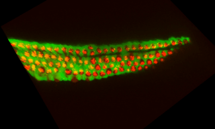 Researchers Uncover Biological Mechanism That Could Reverse Permanent Hearing Loss