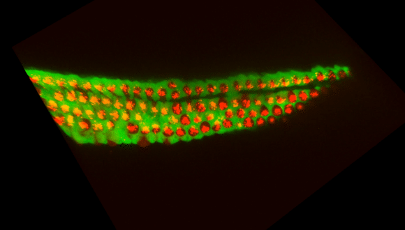 Researchers Uncover Biological Mechanism That Could Reverse Permanent Hearing Loss