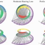 Study Offers New Model of How the Cochlea Processes Sound — With Implications for Hearing Aid Fitting