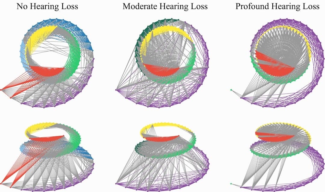 Study Offers New Model of How the Cochlea Processes Sound — With Implications for Hearing Aid Fitting